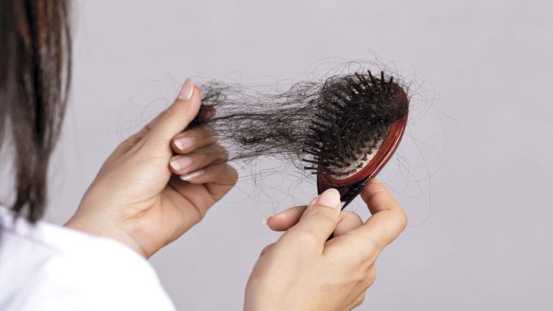 علت انواع مختلف ریزش مو چیست؟ بررسی روش های درمانی آن
